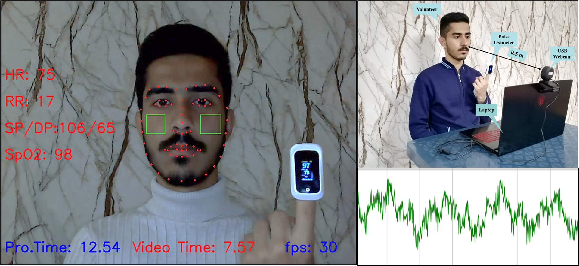 النظام اللاتلامسي لتخمين العلامات الحيوية من صورة وجه الإنسان
